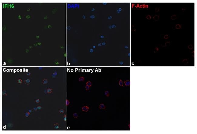 100UG IFI168H37L1MONOANTIBODY 100UG
