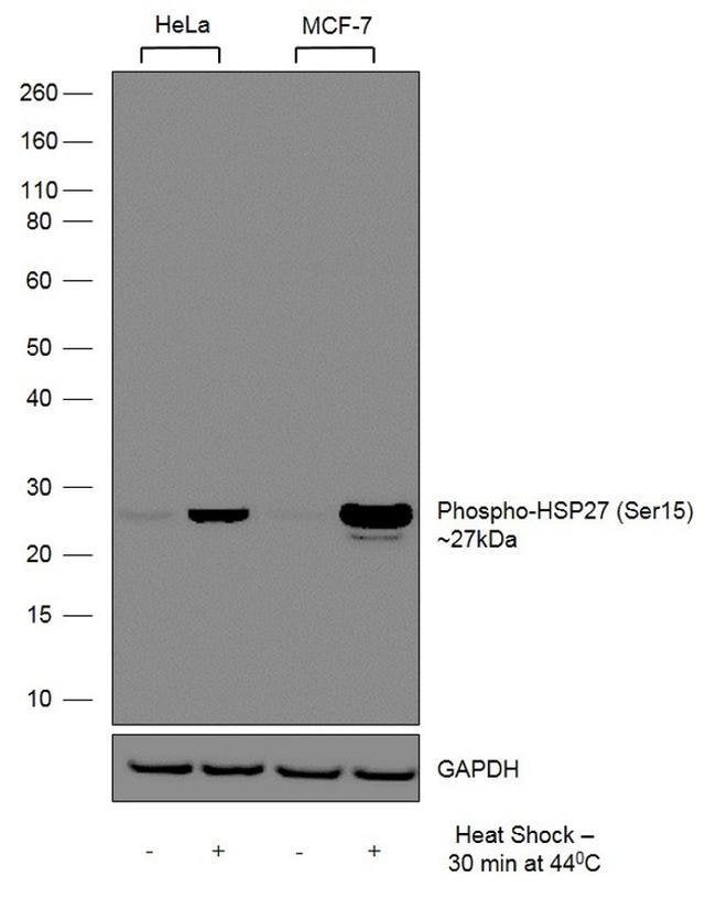 100UG HSP27(PS15)11H29L1MONOANTIBODY 100