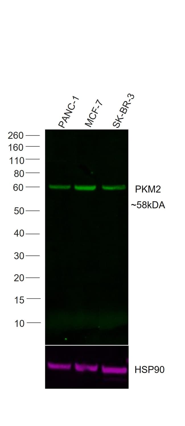 20UG RB PKM2 AFP488 RMAB 20UG
