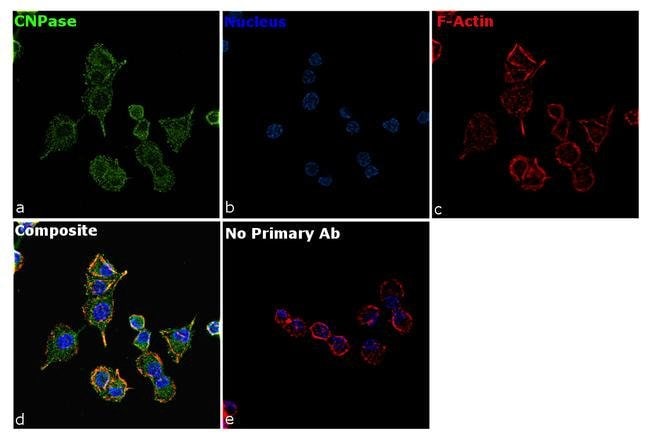 100UG CNPASE5H9L10MONOANTIBODY 100UG