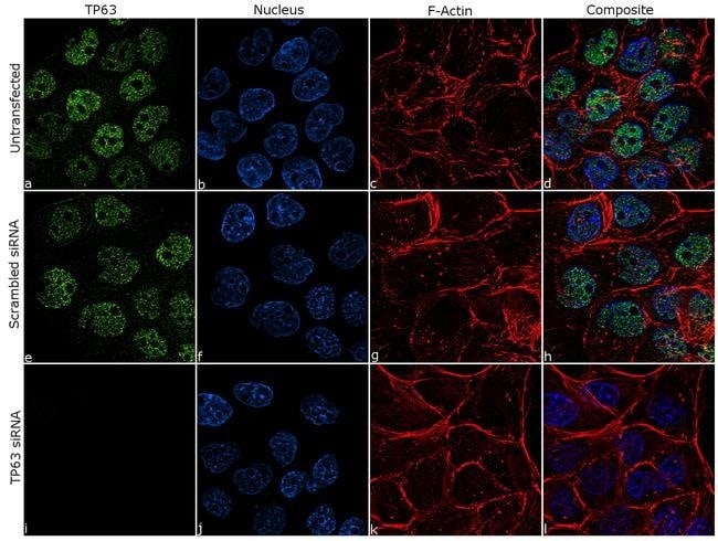 100UG TP6310H7L17MONOANTIBODY 100UG