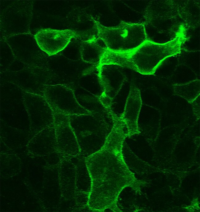 100UG SSTR519H17L5MONOANTIBODY
