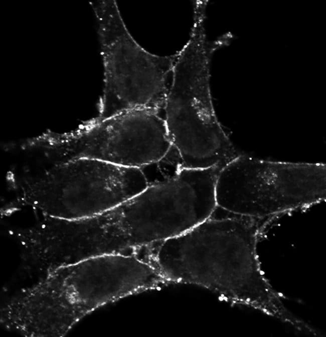 100UG CXCR421H17L11MONOANTIBODY