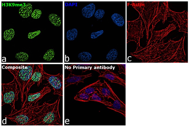 100UG H3K9ME323HCLCPOLYANTIBODY
