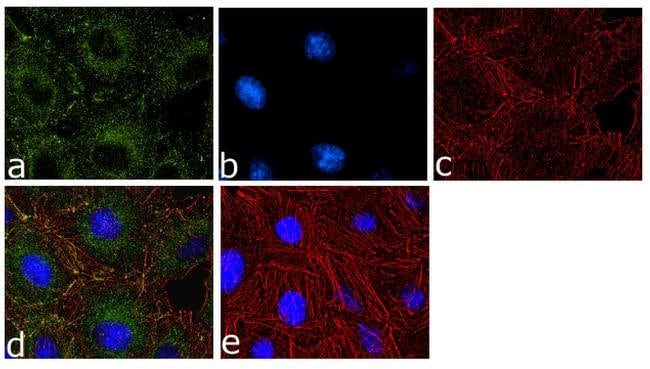 Anti-PRMT3 Rec. Mouse Monoclonal Antibod