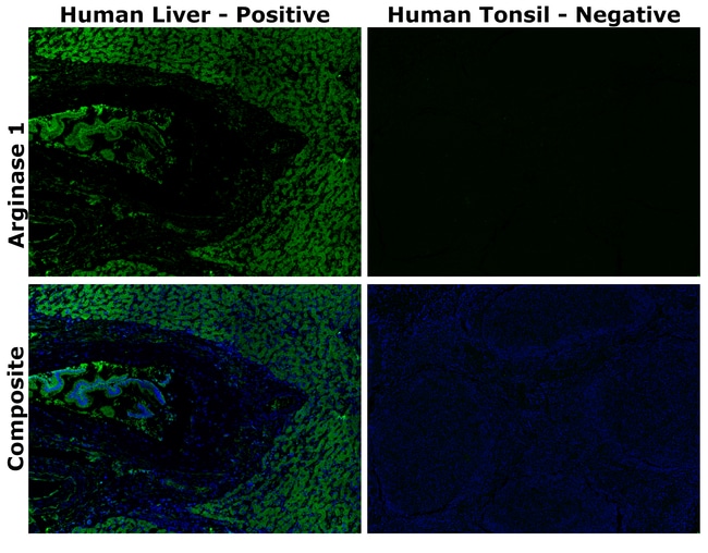 HU ARGINASE1 SL6ARG AFP488 MAB 500 UL