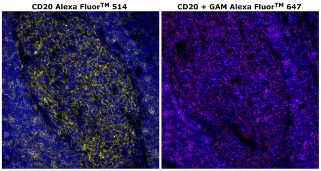 HU CD20 L26 AF514 MAB 500 UL