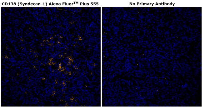 HU CD138 MI15 AFP555 MAB 500 UL