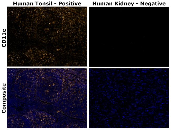 HU CD11C 118/A5 AFP555 MAB 500 UL