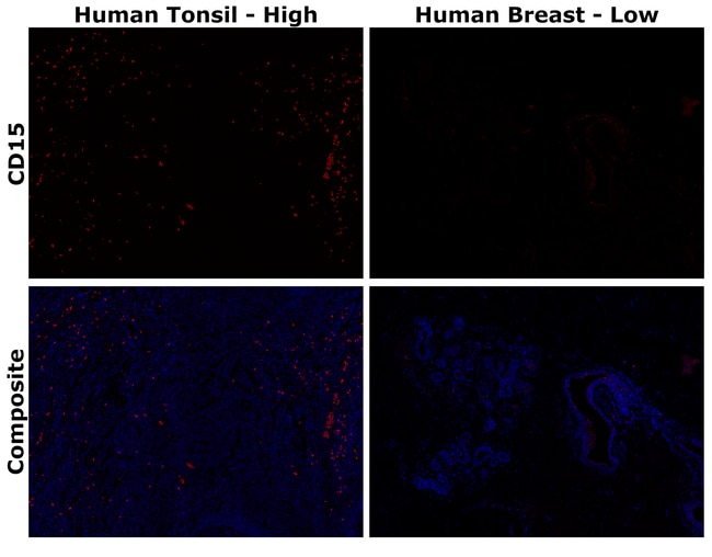 HU CD15 MMA AFP594 MAB 500 UL