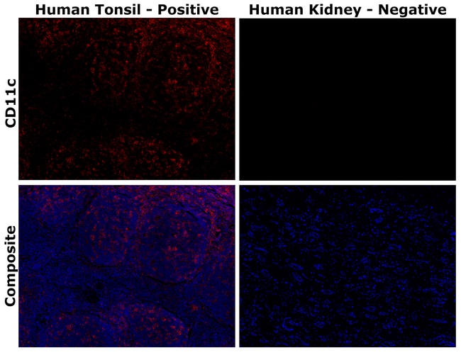 HU CD11C 118/A5 AFP594 MAB 500 UL
