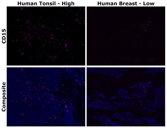 HU CD15 MMA AFP647 MAB 500 UL