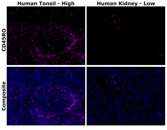 HU CD45RO UCHL1 AFP647 MAB 500 UL