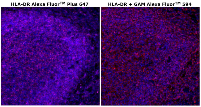 HU HLA-DR LN3 AFP647 MAB 500 UL