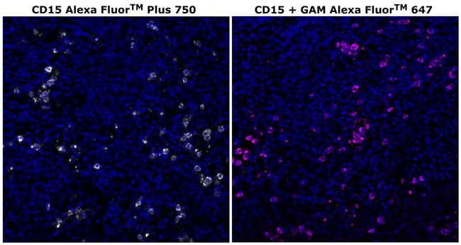 HU CD15 MMA AFP750 MAB 500 UL
