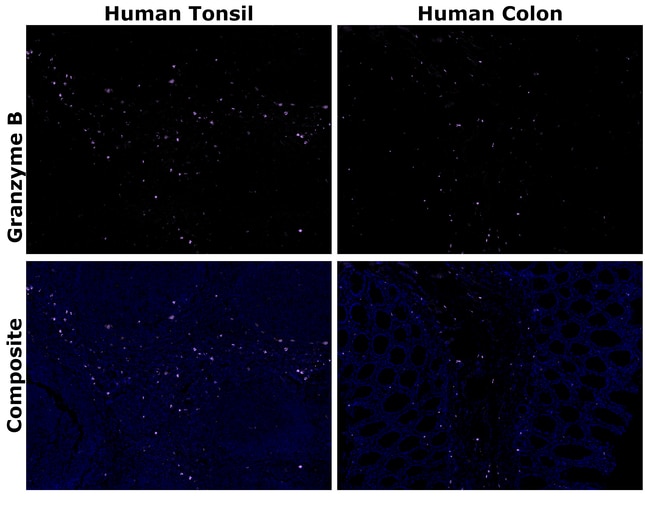 HU GRANZYME B 496B AF420 MAB 500 U L