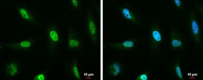 Anti-ATM Protein Antibody, 100 µl 100µL