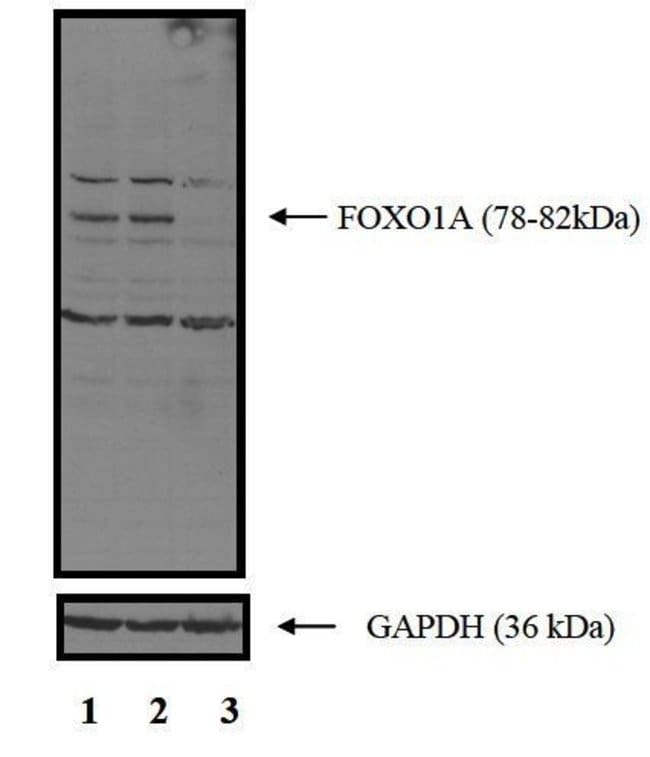 Anti-FOXO1 Protein Antibody, 100 µl 100µ