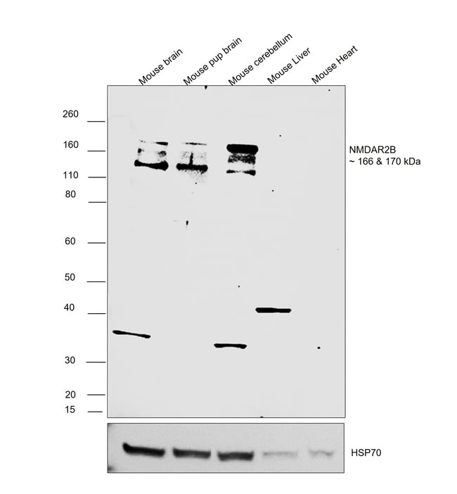 ANTI-NMDA RECEPTOR, SUBUN The anti-NMDA