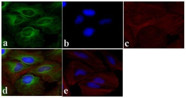 ANTI-ALPHA-TUBULIN (BOVIN anti--tubulin