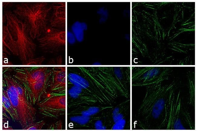 0.5MG Chicken Anti-Mouse IgG (H+L) Antib