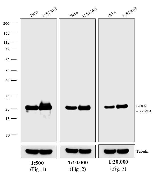1MG Donkey Anti-Mouse IgG (H+L) Antibody