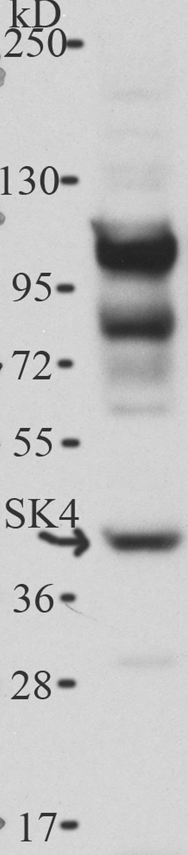 1MG Goat Anti-Rabbit IgG (H+L) Antibody,