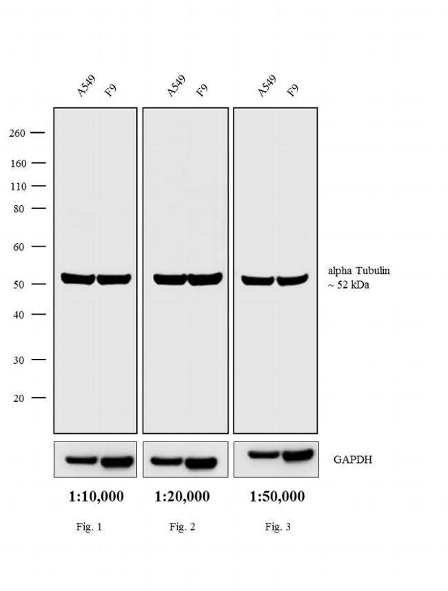 0.5MG CKXRT IGG BIO XADS .