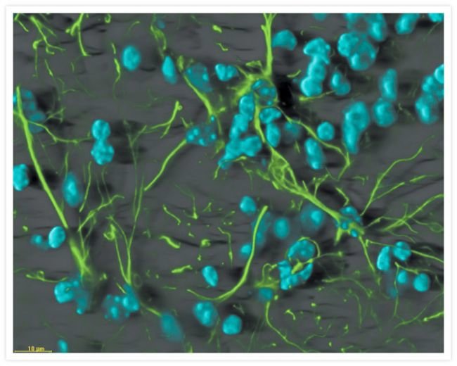 Anti-glial fibrillary acidic protein, Mo