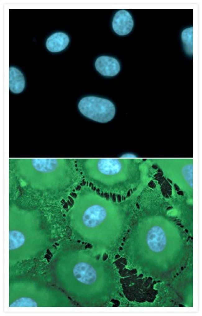 Anti-nitrotyrosine, Rabbit IgG fraction