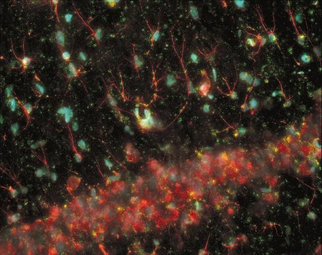 ANTI-GLIAL FIBRILLARY ACI 50 UL The red-