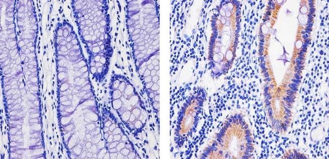 ANTI-OXPHOS COMPLEX IV SU Complex IV sub