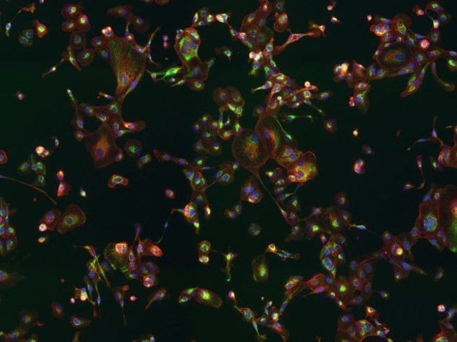 ANTI-OXPHOS COMPLEX V INH ANTI-OXPHOS CO