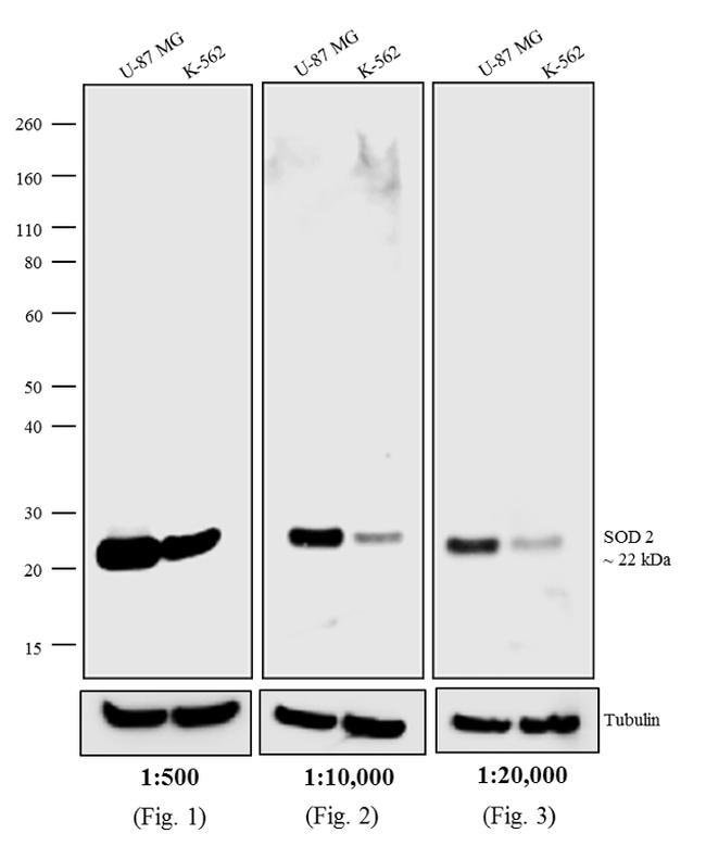 0.5mg Donkey Anti-Mouse IgG (H&L) Antibo