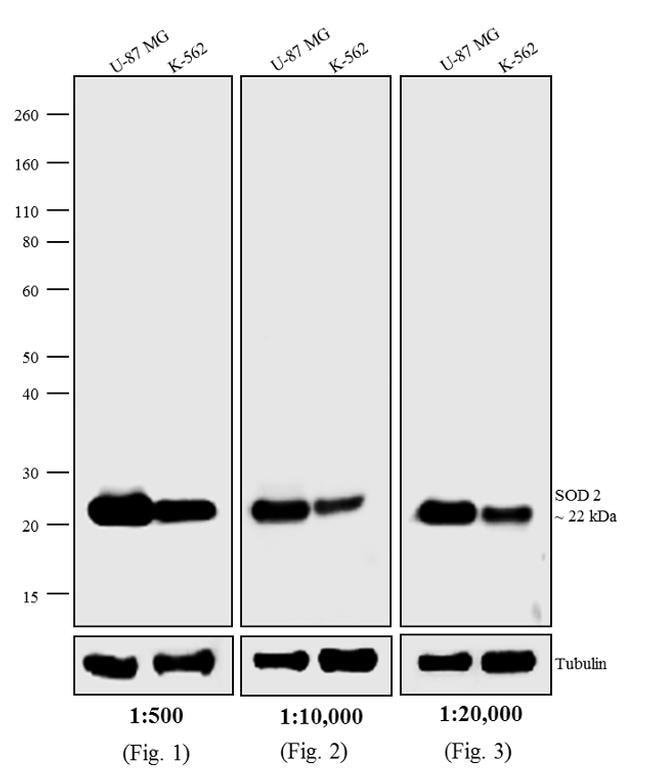 0.5MG DKXMU AP HIGH XADS F(AB')2