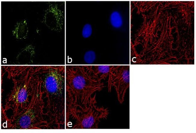 ANTI-OXPHOS COMPLEX IV SU Complex IV sub