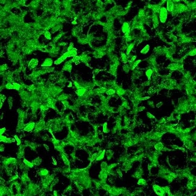 AANAT Polyclonal Antibody, 100 µg