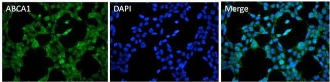 ABCA1 Polyclonal Antibody, DyLight 488 c