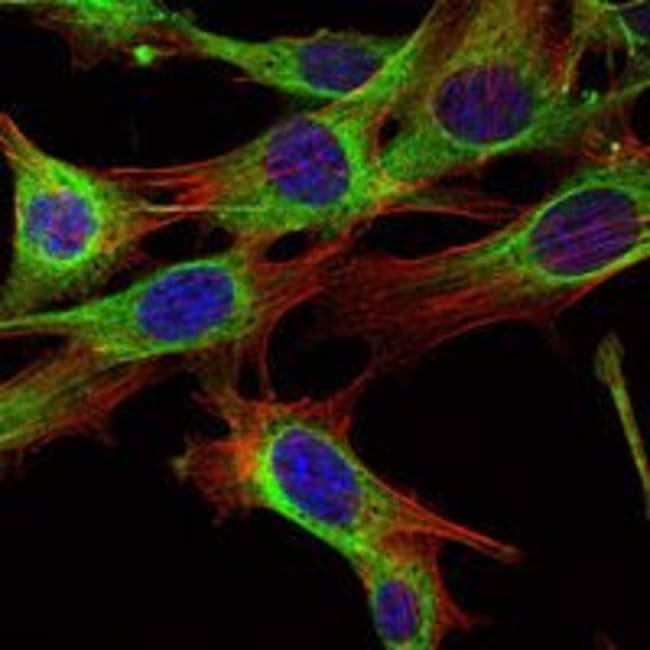 ABL2 Monoclonal Antibody 100 µl µL