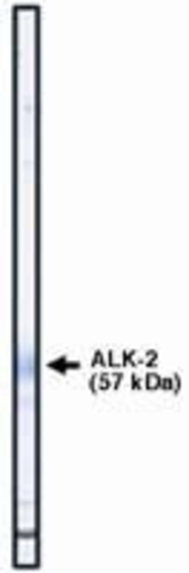 ACTIVIN RECEPTOR TYPE IA