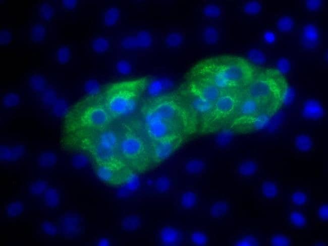 Alpha Fetoprotein Monoclonal Antib. 100