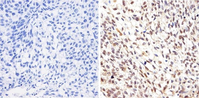 AKT (9Q7) unconj, Mouse monoclonal Antib