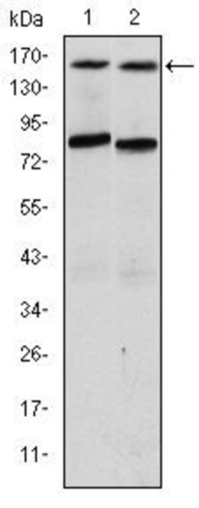 AIB1 Monoclonal Antibody (5H3), 100 µl