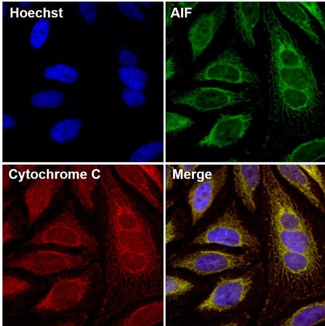 AIF Monoclonal Antibody (4E7), 100 µl