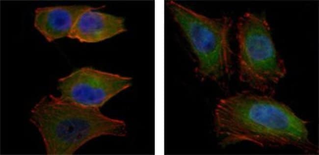 AKT2 Monoclonal Antibody 100 µl µL
