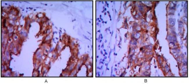 ALPP Monoclonal Antibody 100 µl µL
