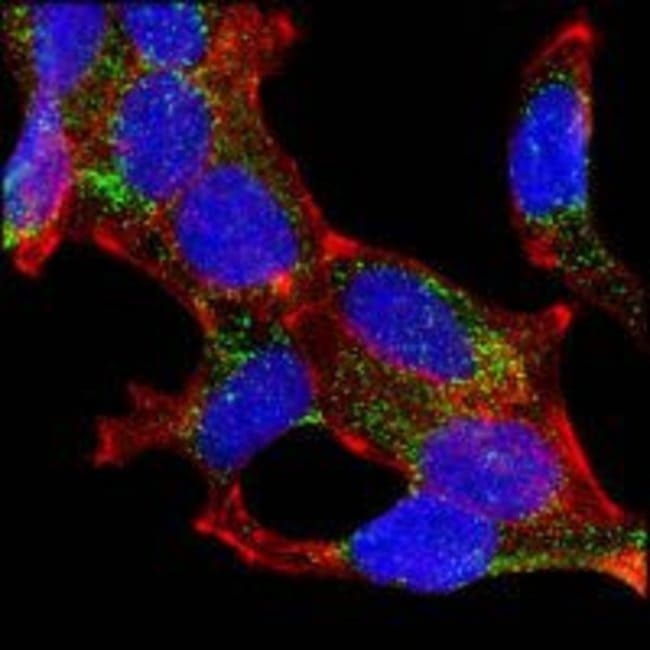 AMACR Monoclonal Antibody 100 µl µL
