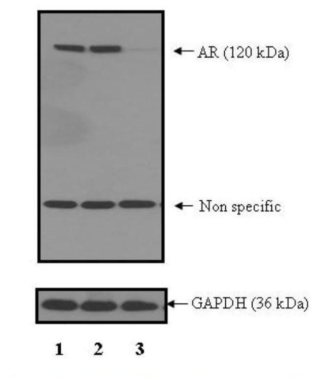 ANDROGEN RECEPTOR, 100 µL