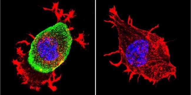 Acetylcholinesterase Mouse Monoclonal Ab