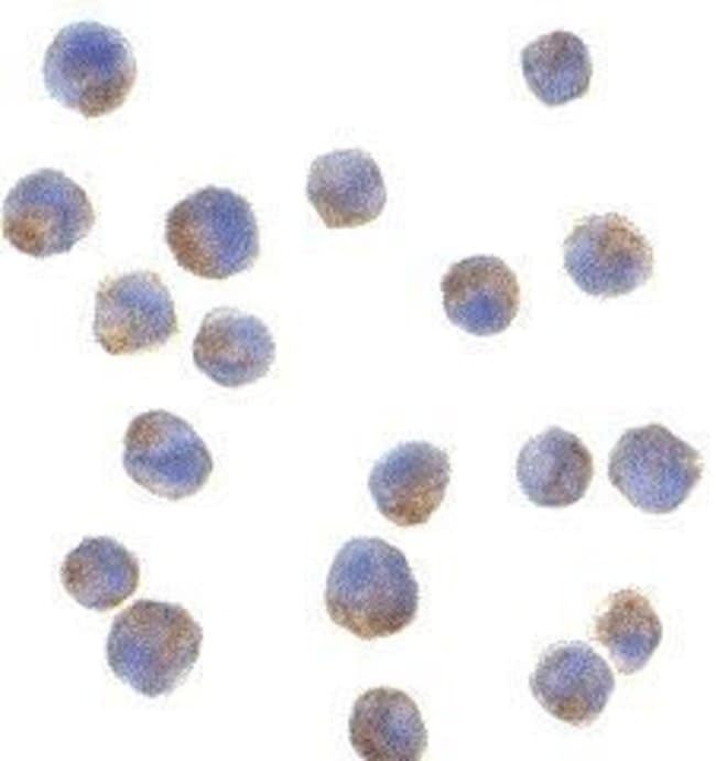ADIPONECTIN